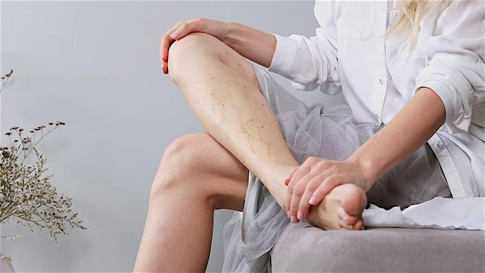 Sclerotherapy for Physicians & Nurses - Miami / Miami Beach, FL