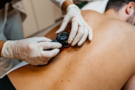Melanoma Study Day