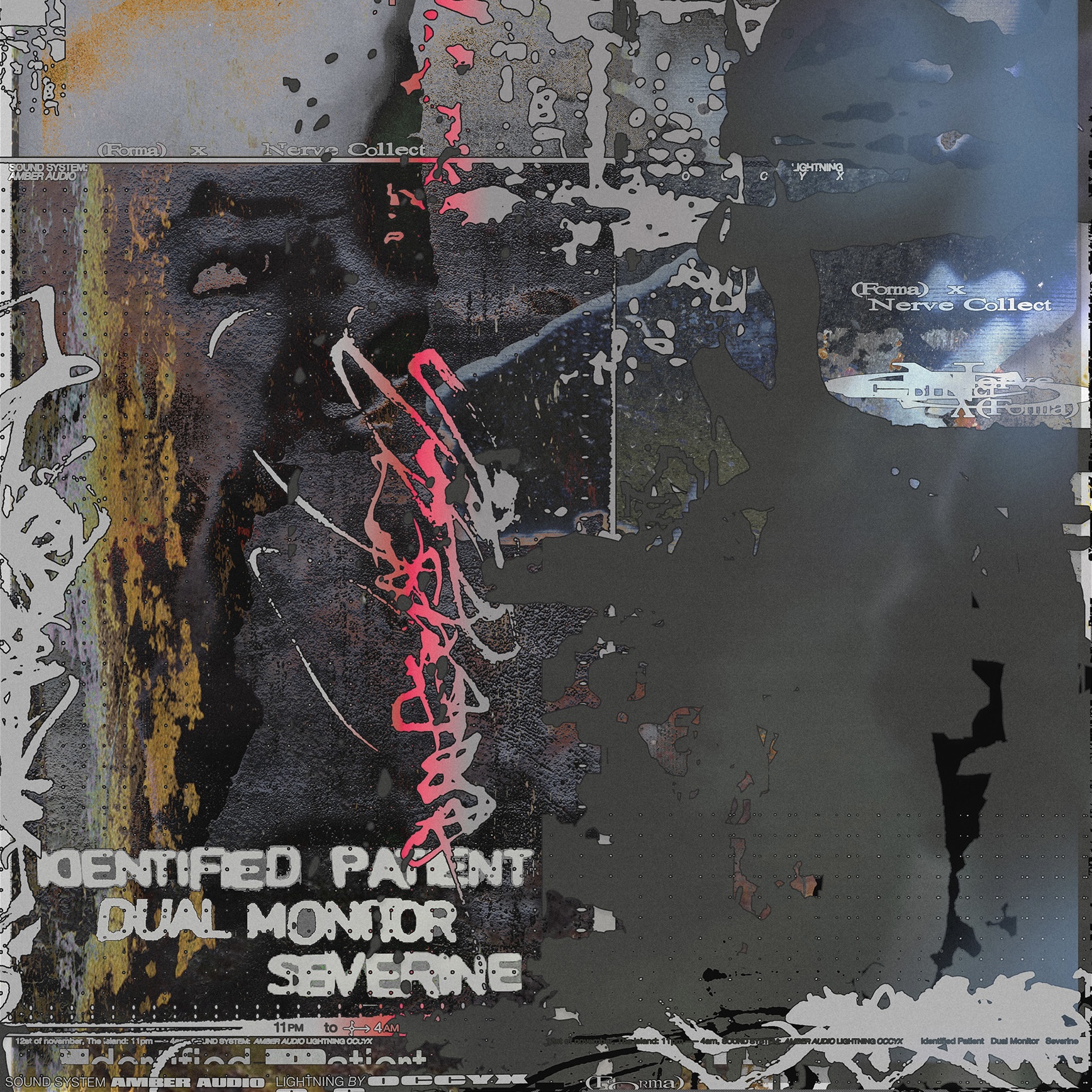 forma x Nerve Collect: Identified Patient, Dual Monitor & severine