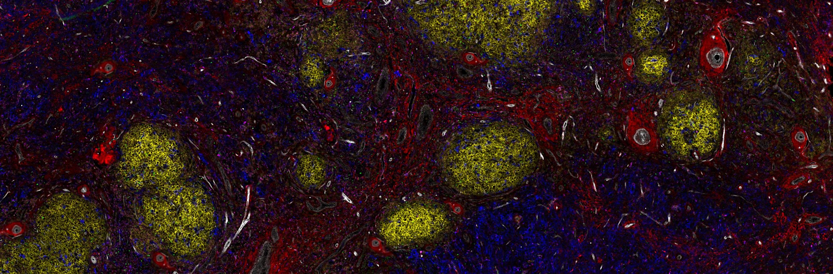 Crick Cancer Symposium 2026