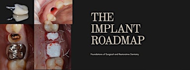 The Implant Roadmap 101