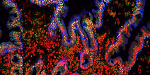 The London Immunity in Health and Disease Symposium