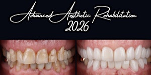 Advanced Aesthetic Rehabilitation (AAR) Melbourne