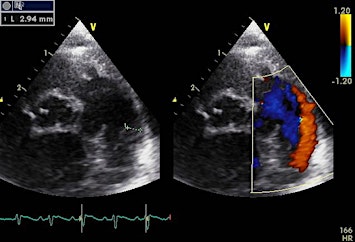 Monash Cardiorespiratory Symposium (Fetal-Neonatal-Pediatric)