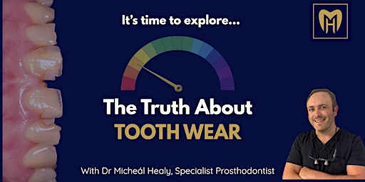 The Truth About Tooth Wear