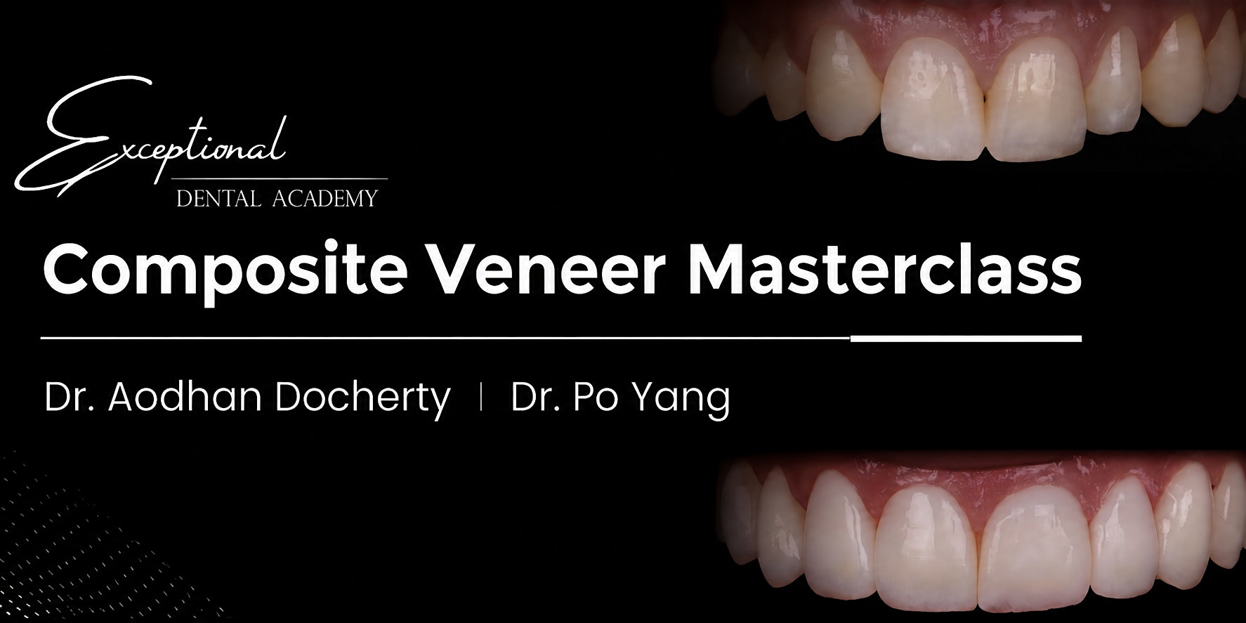 Composite Veneer Masterclass (Melbourne)